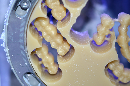 Medical ceramic application Medical ceramic application